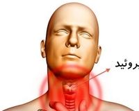 هرآنچه باید درباره کم‌کاری تیروئید و عوامل ایجاد آن بدانید