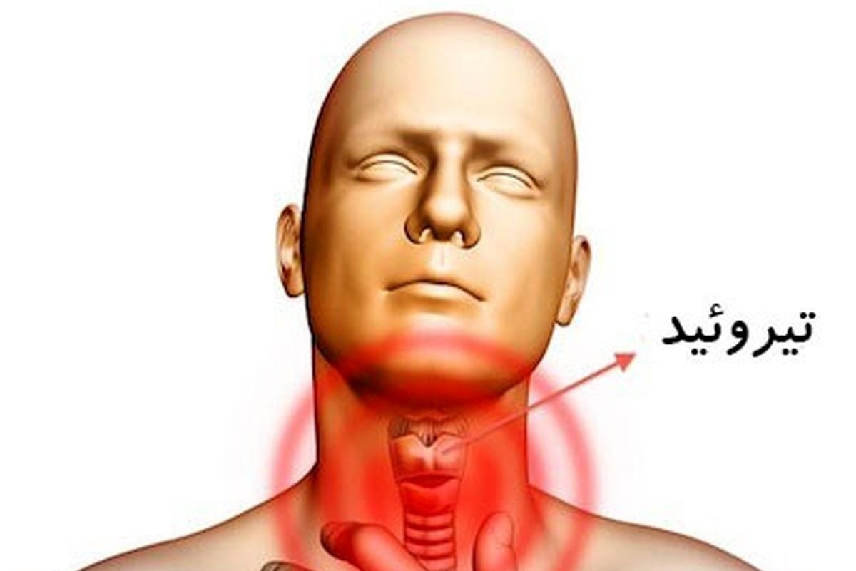 هرآنچه باید درباره کم‌کاری تیروئید و عوامل ایجاد آن بدانید