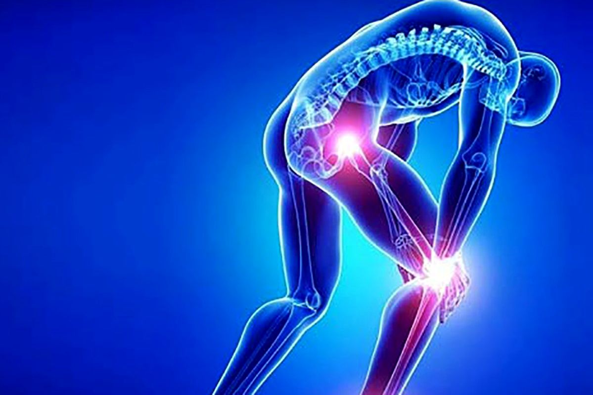راه‌حل کاربردی برای کاهش درد سیاتیک هنگام خواب