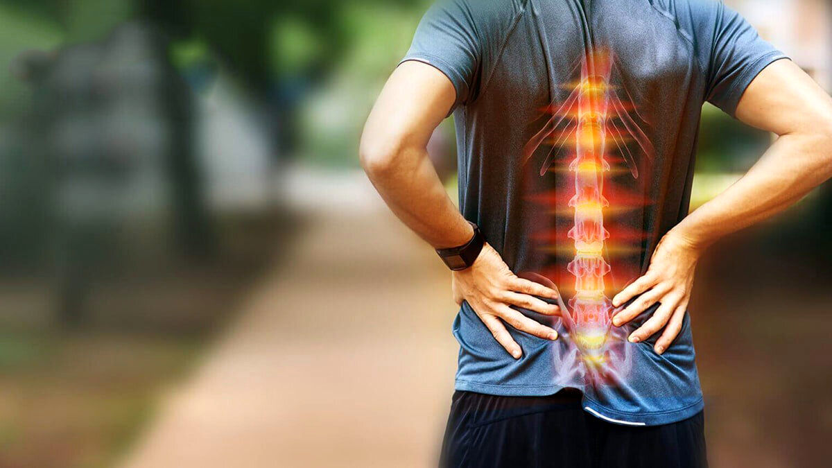 علائم دیسک کمر؛‌‌ این نشانه‌ها را جدی بگیرید!